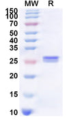 Recombinant Human SLC15A2 Protein, N-His