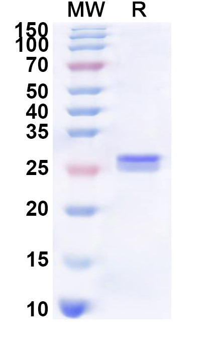 Recombinant Human SLC15A2 Protein, N-His