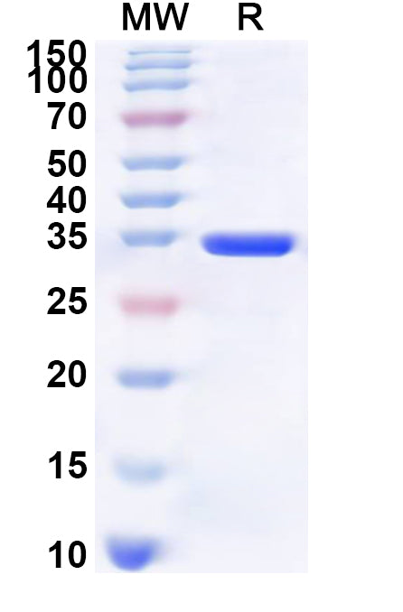 Recombinant Human INA Protein, N-His