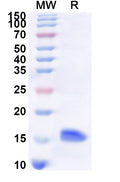 Recombinant Human KCNMB1 Protein, N-His