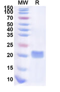 Recombinant Human ME3 Protein, N-His