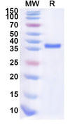 Recombinant Human SLC19A3 Protein, N-GST & C-His
