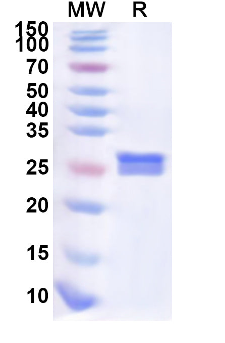Recombinant Human SGCA Protein, N-His