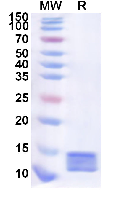 Recombinant Human DUOXA2 Protein, N-His