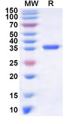Recombinant Human KLF9 Protein, N-His