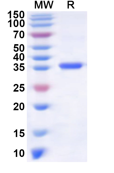 Recombinant Human KLF9 Protein, N-His