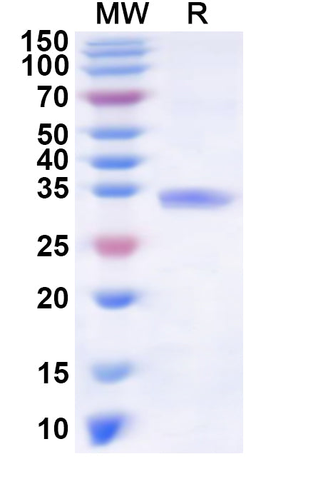 Recombinant Human TNFAIP1 Protein, N-His