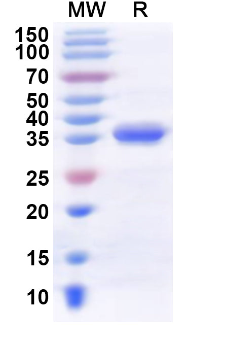 Recombinant Human KMT5B Protein, N-His
