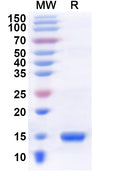 Recombinant Human BRDT Protein, N-His