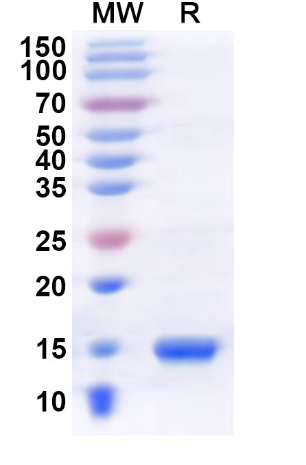 Recombinant Human BRDT Protein, N-His
