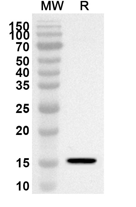 Western blot analysis was performed using anti-BRDT polyclonal antibody at 1ug/mL on recombinant BRDT (Catalog No. HA831012).