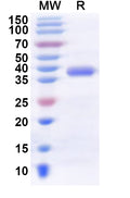 Recombinant Human DCAF6 Protein, N-His