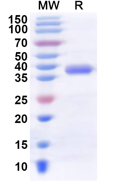 Recombinant Human DCAF6 Protein, N-His