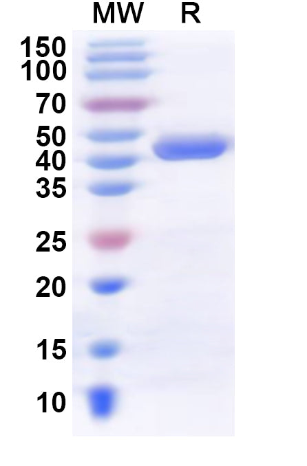 Recombinant Human CMPK2 Protein, N-His