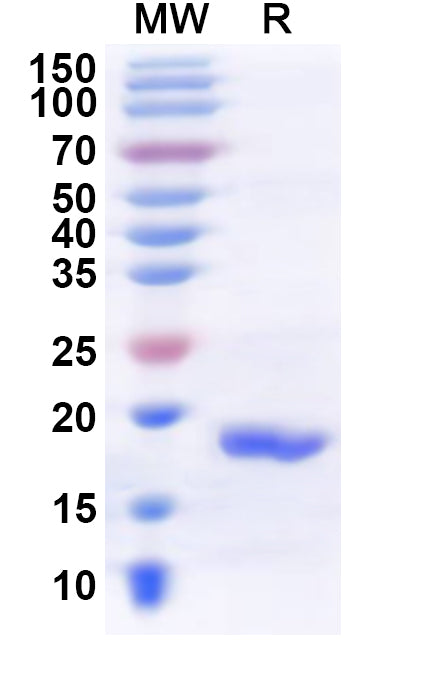 Recombinant Human RNF212 Protein, N-His