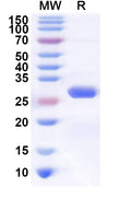 Recombinant Human TJAP1 Protein, N-His