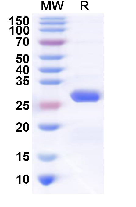Recombinant Human TJAP1 Protein, N-His