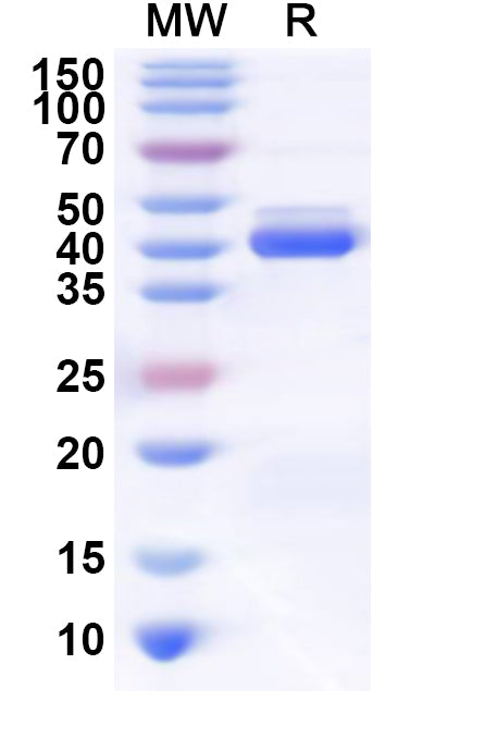 Recombinant Human SNAPC4 Protein, N-His