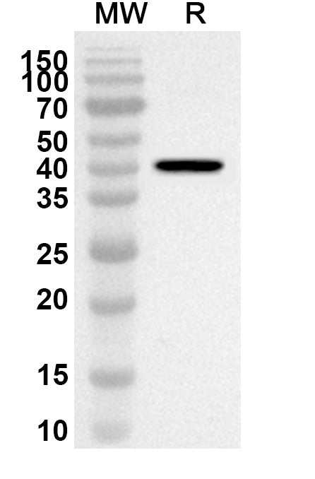 Western blot analysis was performed using anti-SNAPC4 polyclonal antibody at 1ug/mL on recombinant SNAPC4 (Catalog No. HA836012).