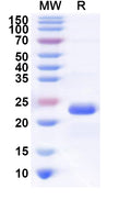 Recombinant Human OTUD3 Protein, N-His