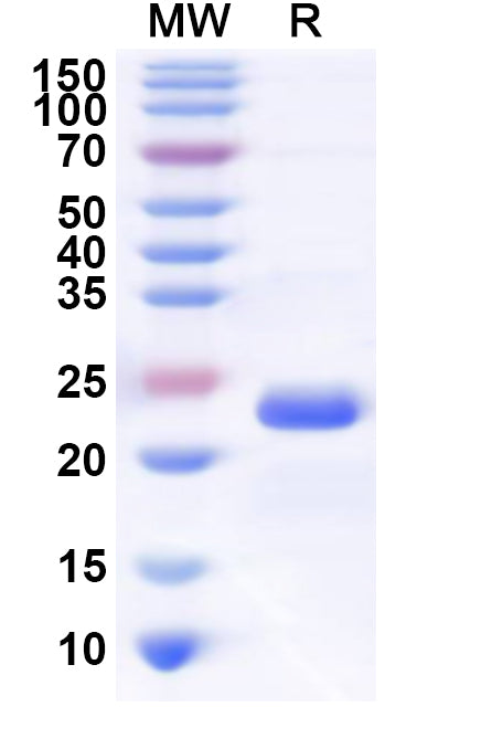 Recombinant Human OTUD3 Protein, N-His