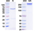 SDS-PAGE for Anti-DNAH1 Antibody (N251/14)