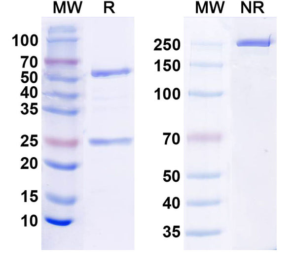 SDS-PAGE for Anti-SALM5 Antibody (N140A/12)