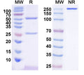 SDS-PAGE for Anti-Arx Antibody (N411/51)