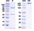 SDS-PAGE for Anti-Arx Antibody (N411/70)