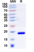 Recombinant Human ZNF746 Protein, N-His