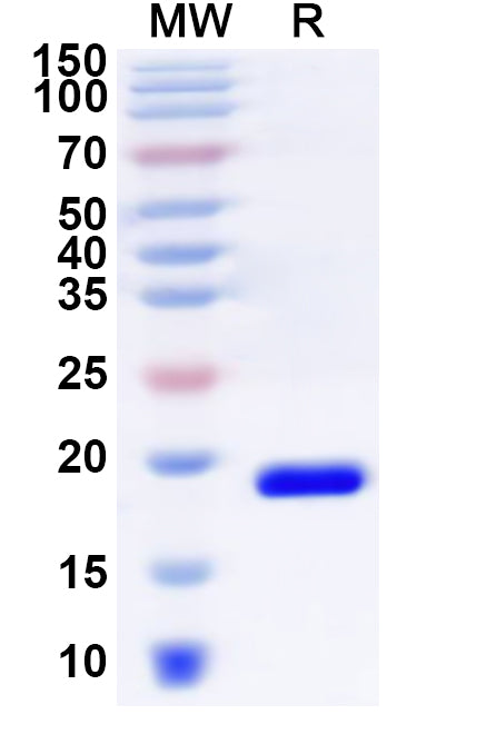 Recombinant Human ZNF746 Protein, N-His