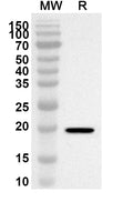 Western blot analysis was performed using anti-ZNF746 polyclonal antibody at 1ug/mL on recombinant ZNF746 (Catalog No. HA866012).