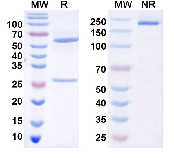 SDS-PAGE for Anti-PARIS/ZNF746 Antibody (N196/16)