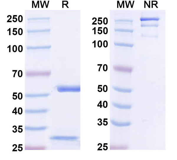 SDS-PAGE for Anti-DNAH7 Antibody (N250/21)