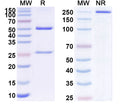 SDS-PAGE for Anti-ANO9/TMEM16J Antibody (N443/15)