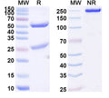 SDS-PAGE for Anti-Human ANKRD30A/NY-BR-1 Antibody (SAA1895)