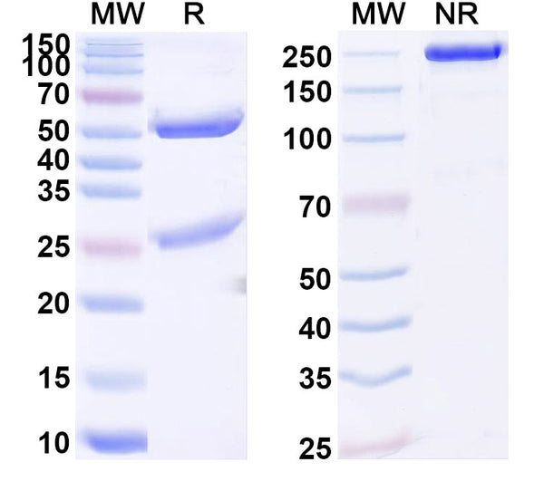 SDS-PAGE for Anti-Human ANKRD30A/NY-BR-1 Antibody (SAA1895)