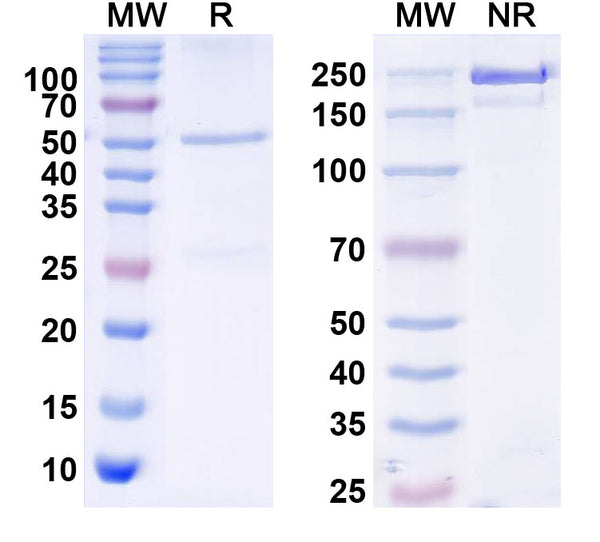 SDS-PAGE for Anti-Iduna/RNF146 Antibody (N201/35)