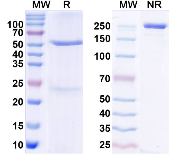 SDS-PAGE for Anti-Iduna/RNF146 Antibody (N201/4)