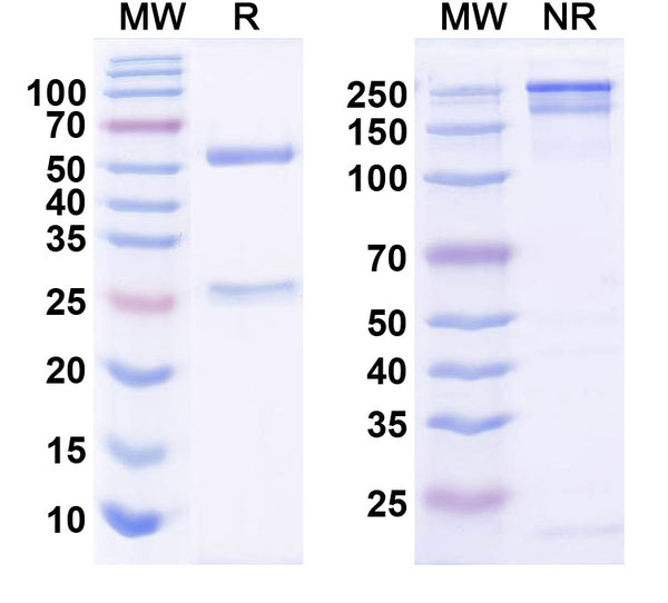 SDS-PAGE for Anti-Shank3 Antibody (N367/62)