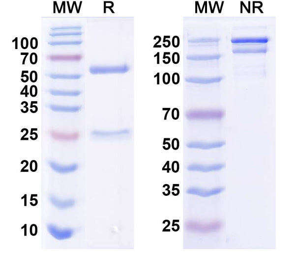 SDS-PAGE for Anti-Shank3 Antibody (N69/46)