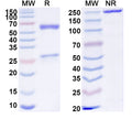 SDS-PAGE for Anti-Human TMEM219 Antibody (SAA1858)