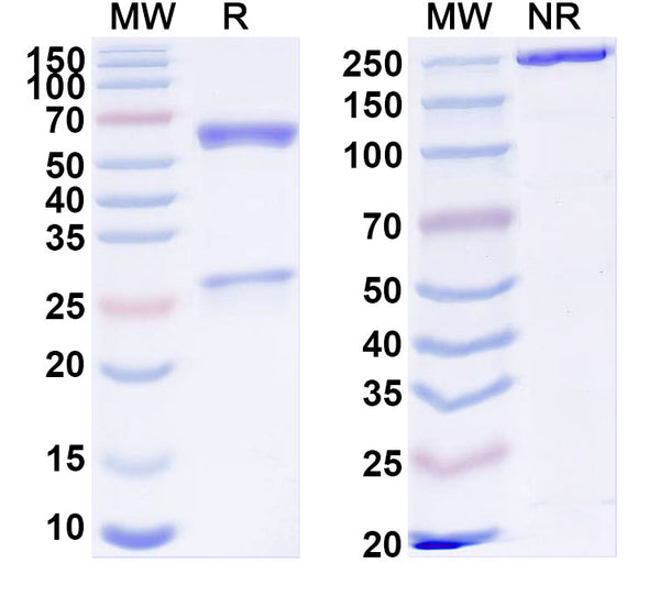 SDS-PAGE for Anti-Human TMEM219 Antibody (SAA1858)