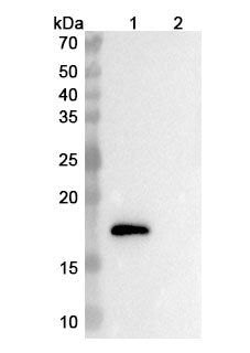 Anti-Human TMEM219 Reference Antibody (Ebrasodebart) – Figure 1 of 2