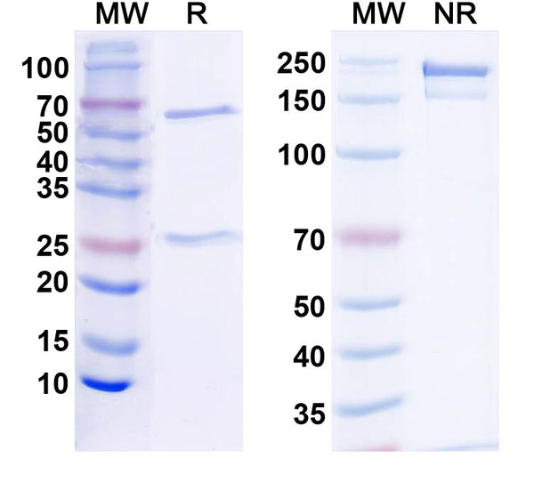 SDS-PAGE for Anti-Shank2 Antibody (N23B/6)