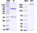 SDS-PAGE for Anti-Gamma-protocadherin-C5 Antibody (N189C/95)