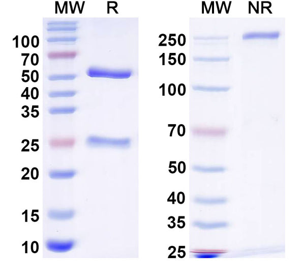 SDS-PAGE for Anti-Gamma-protocadherin-C5 Antibody (N189C/95)