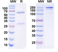 SDS-PAGE for Anti-ANO3/TMEM16C Antibody (N454/91)