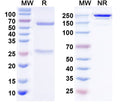 SDS-PAGE for Anti-BBS3/Arl6 Antibody (N302/46)