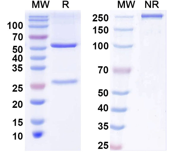 SDS-PAGE for Anti-BBS5 Antibody (N304B/115)